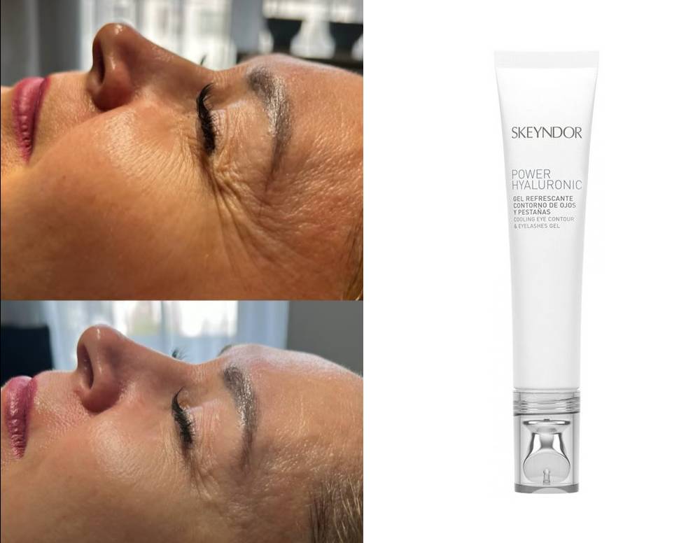 Skeyndor Eye – Zabieg na Skórę Wokół Oczu